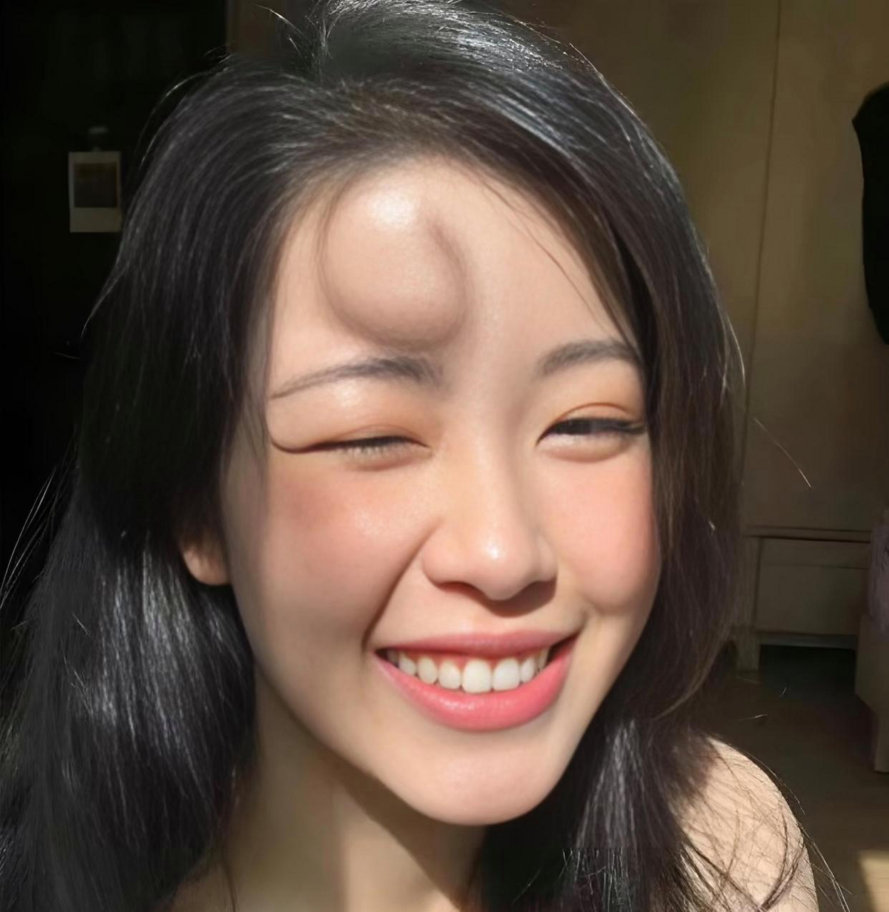 头上长这么大的包,还这么开心.果然不是一般人.  心态要好.