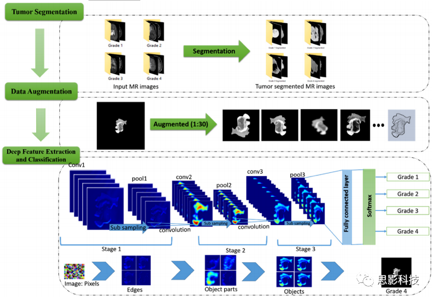 使用数据增强的卷积神经网络进行肿瘤分级