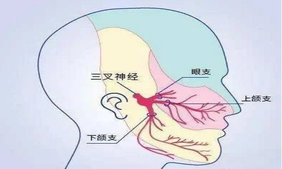 三叉神经痛部位分布图图片