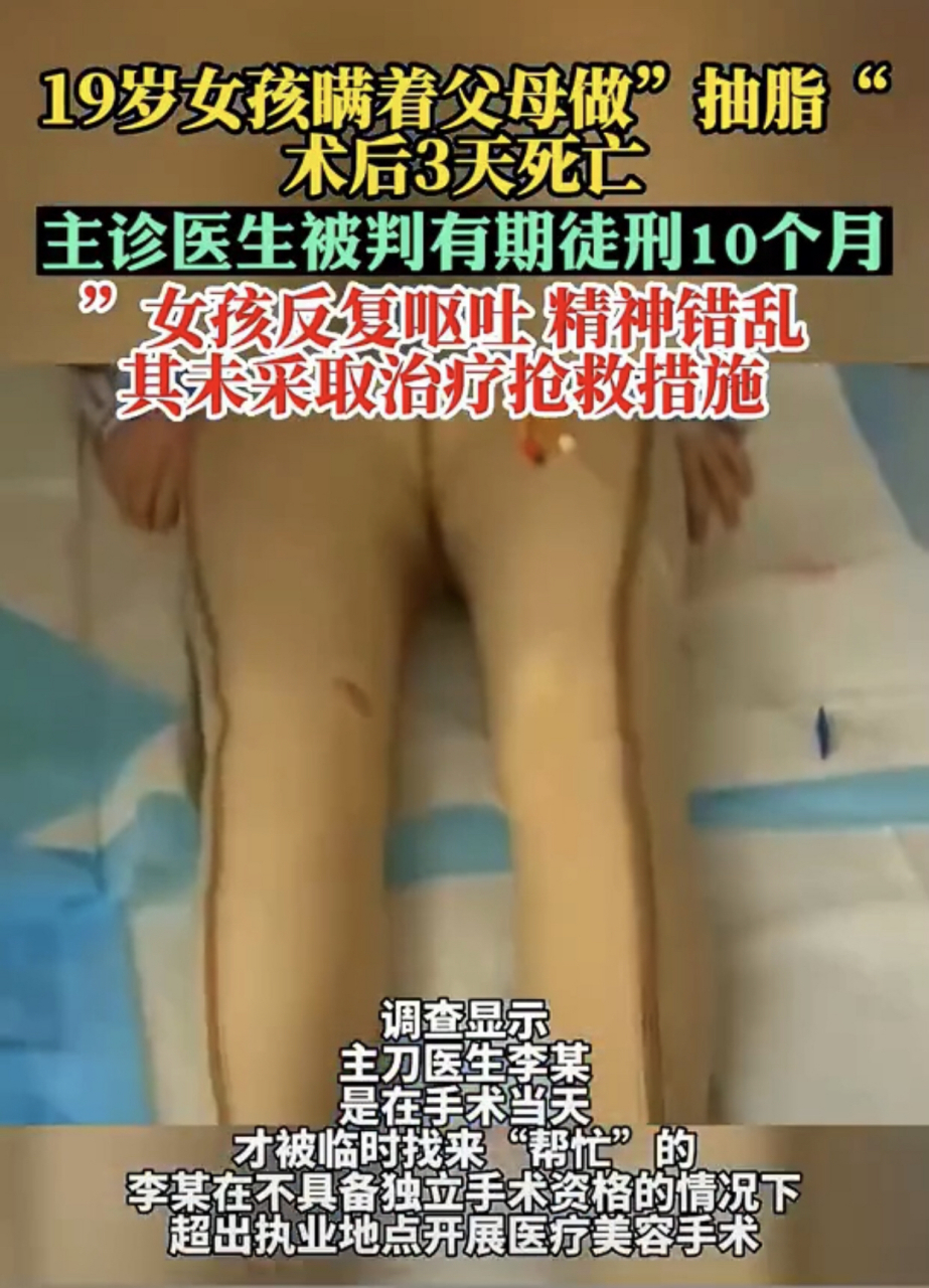 19岁女孩瞒着父母去整形医院抽脂后3天死亡.#社会百态#  #奇闻趣事