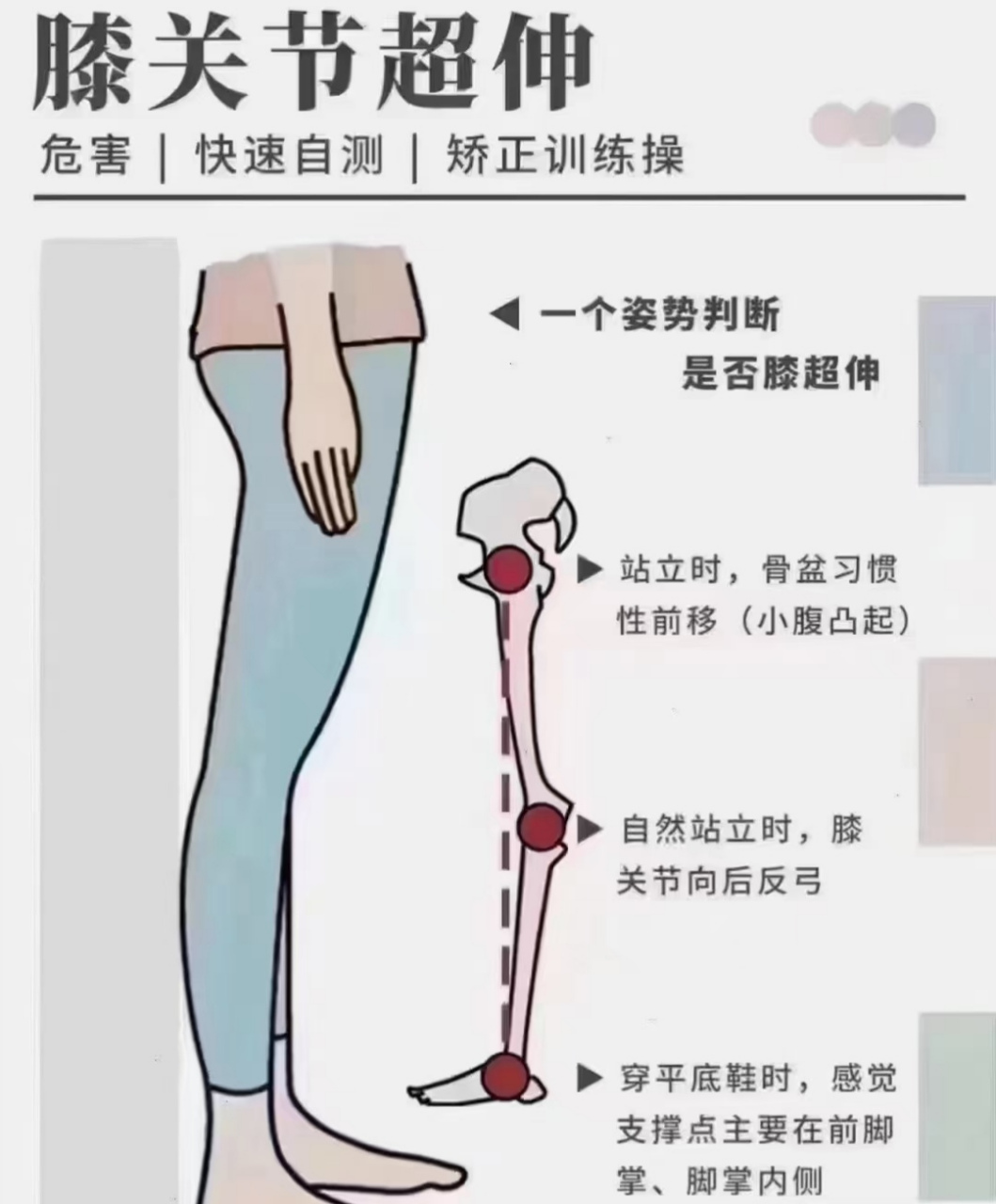 7215 7215 7215 膝超伸的危害 1.磨损膝关节 2.