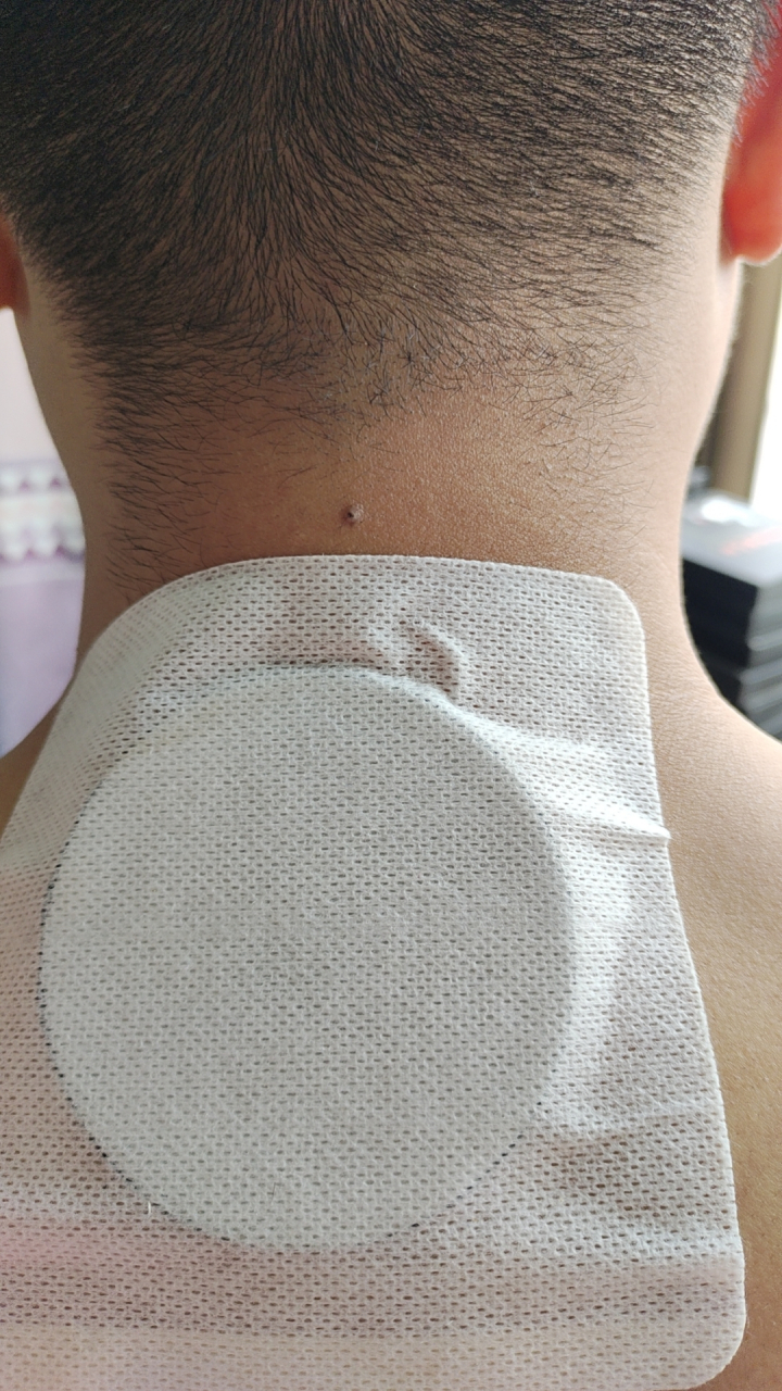 膏药贴敷示意图