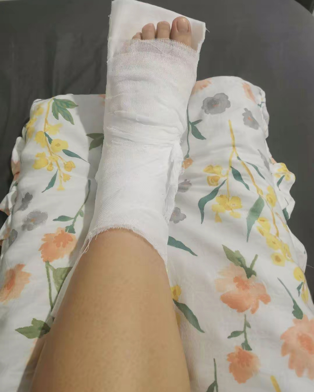 在网上买的蛇皮丝袜,本想给老公增加点情趣,谁知老公看了一下,以为是