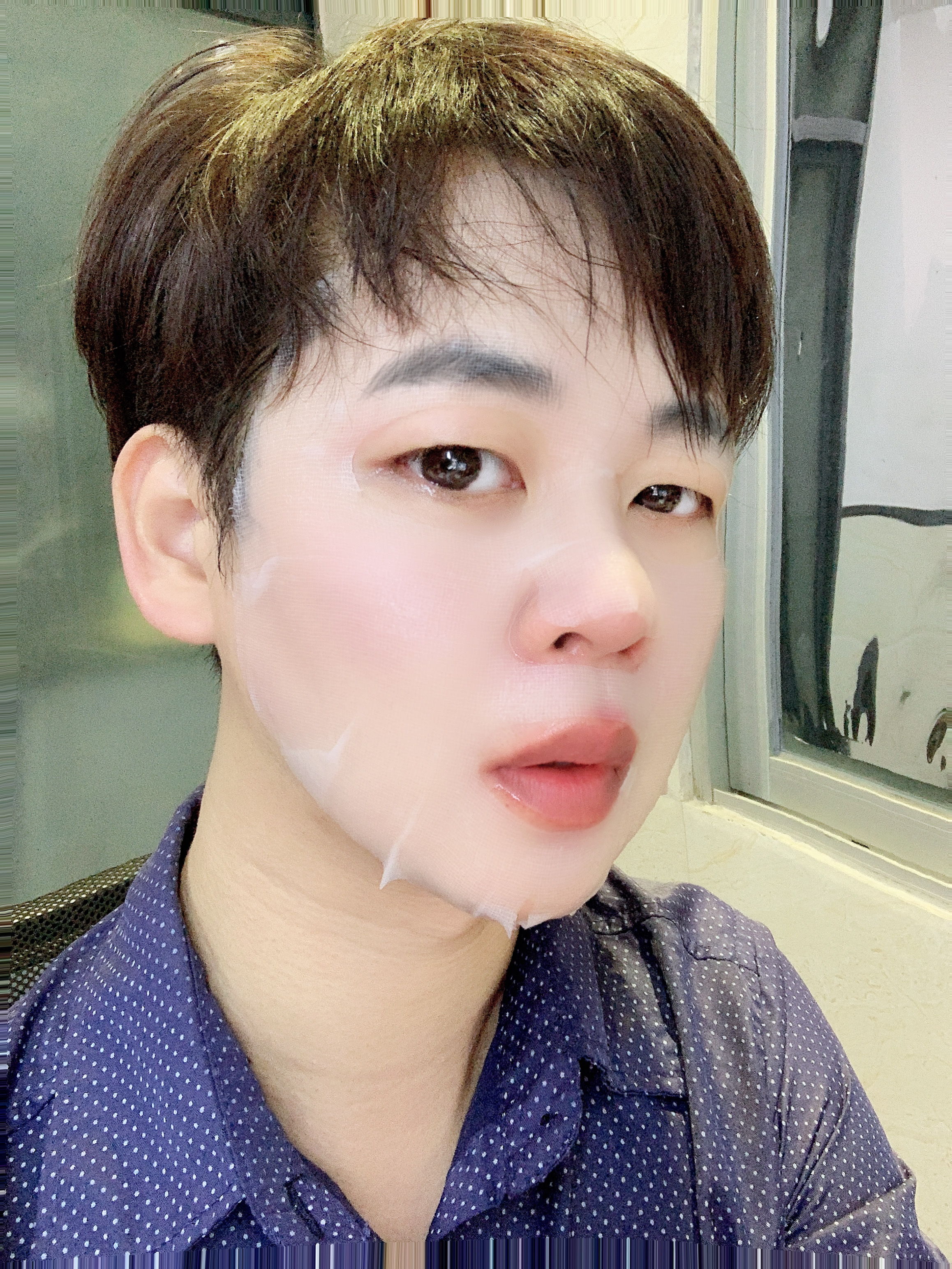 yester透明质酸套组-光电术后修护常备