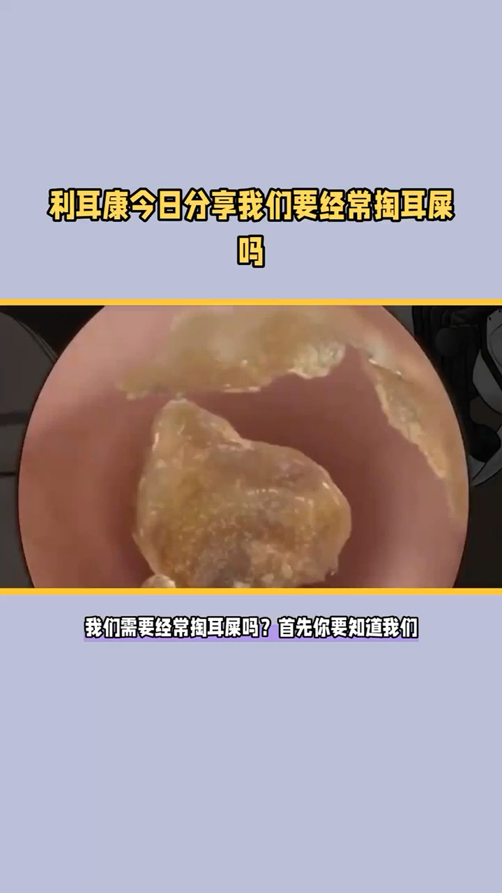 有多少人知道我们耳朵里的耳屎需要经常掏吗?