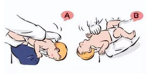 婴儿海姆立克急救法怎么操作