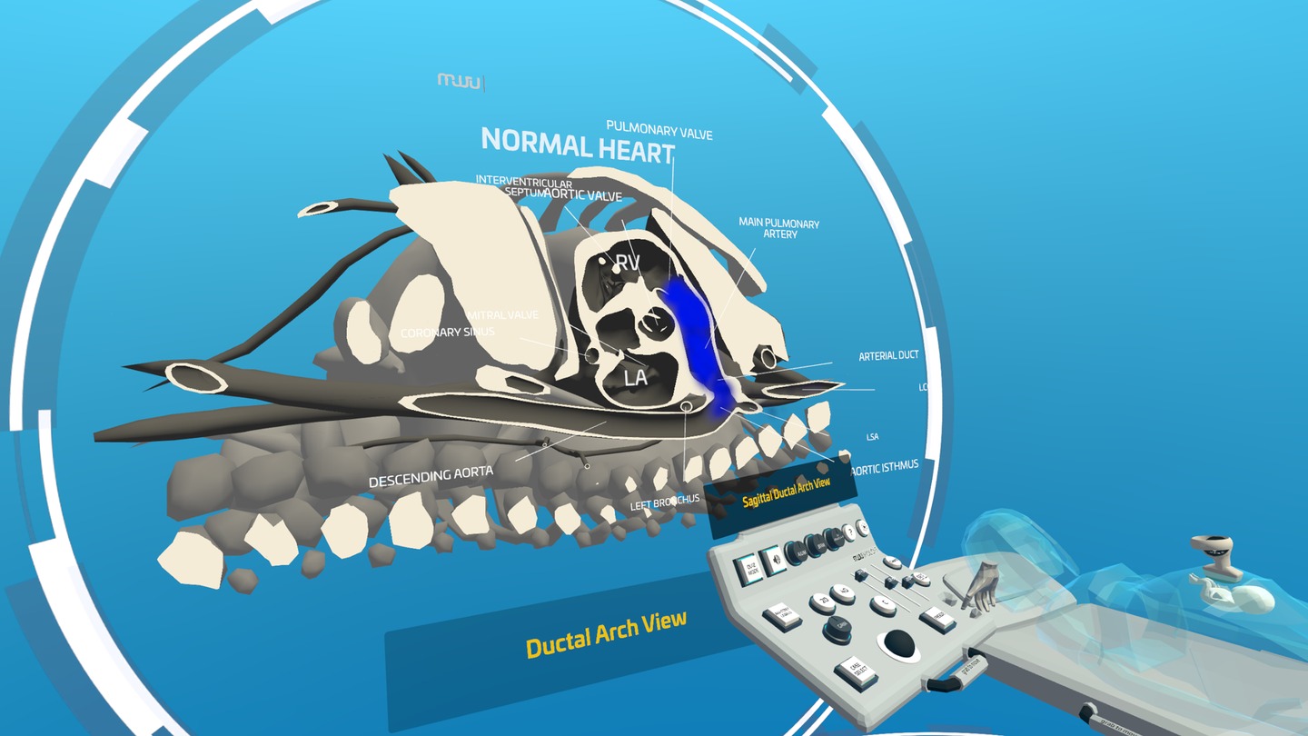 《心脏病医学VR》Fetal Heart VR
