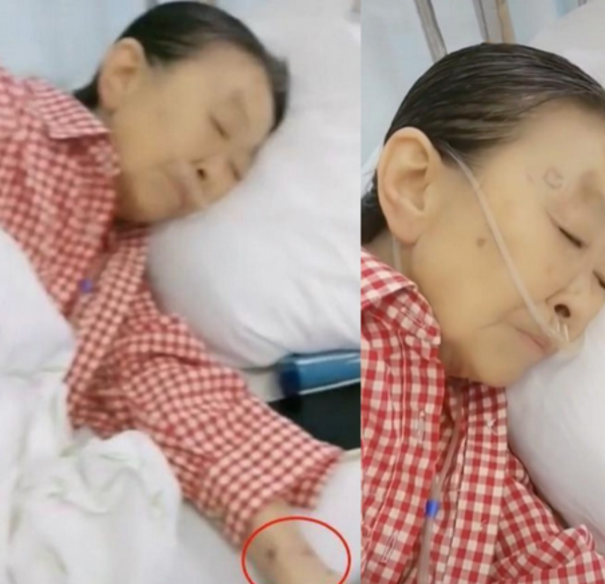 "丑娘"张少华去世,生前一直在忍受病痛折磨