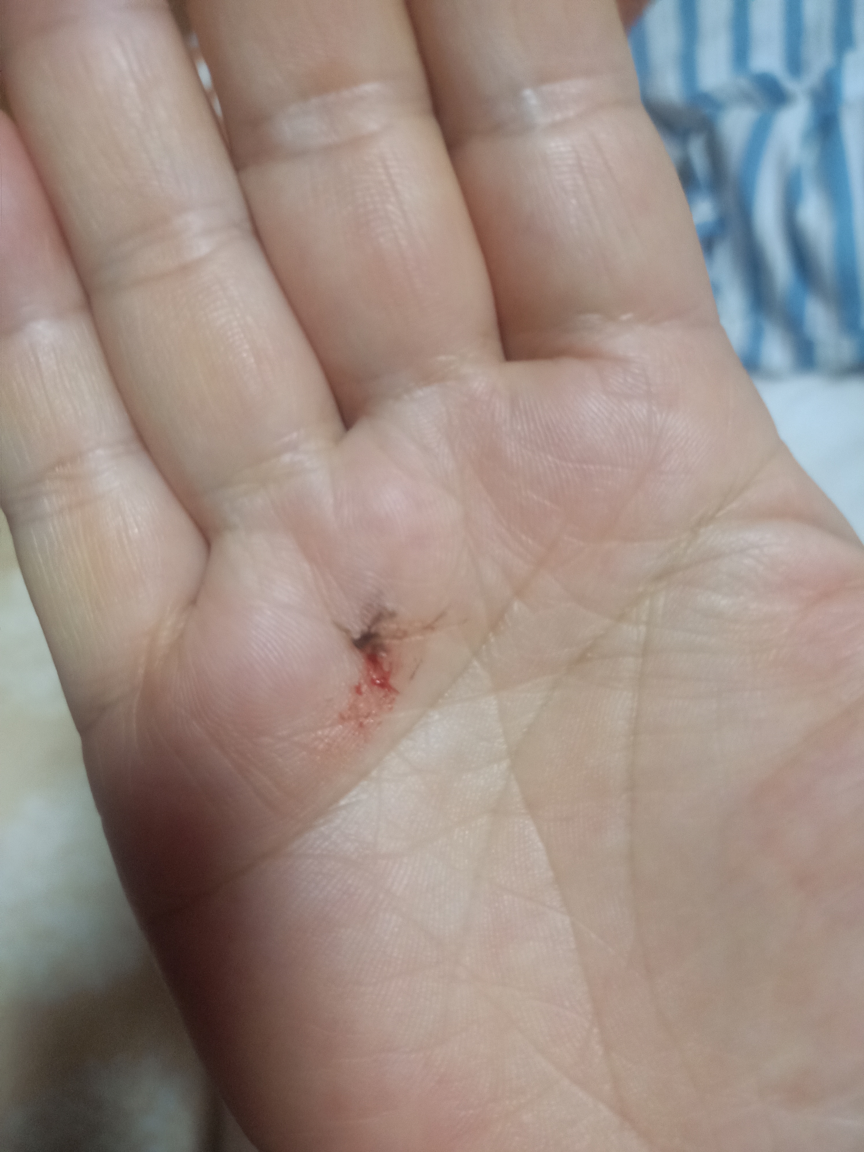 朋友们谁懂啊穿羽绒服的季节被两只蚊子骚扰了一夜好歹打死了一只