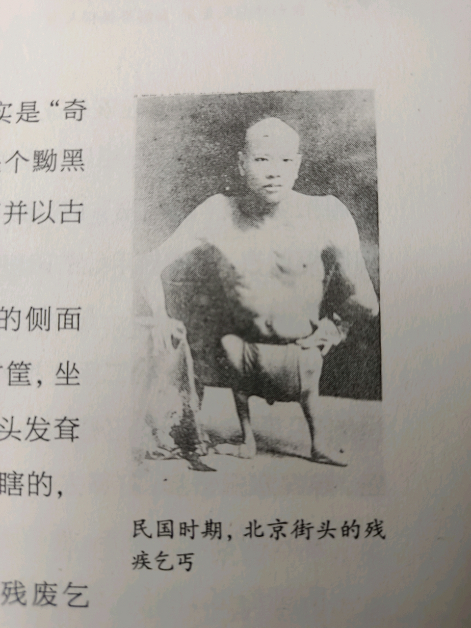 大头人,头大如翁,却长了个婴儿身,其原材料就是半岁大的婴儿.