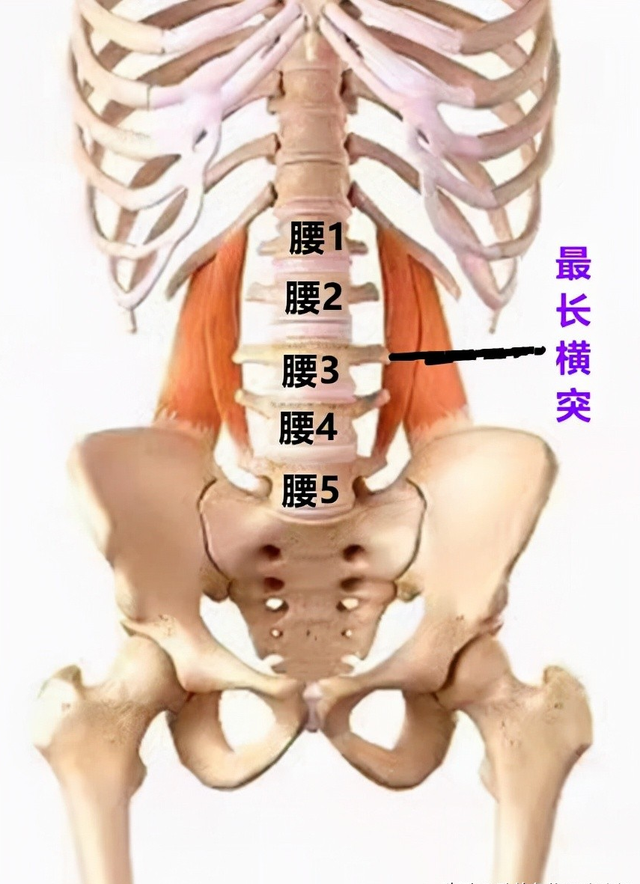 折磨人的腰三横突综合征