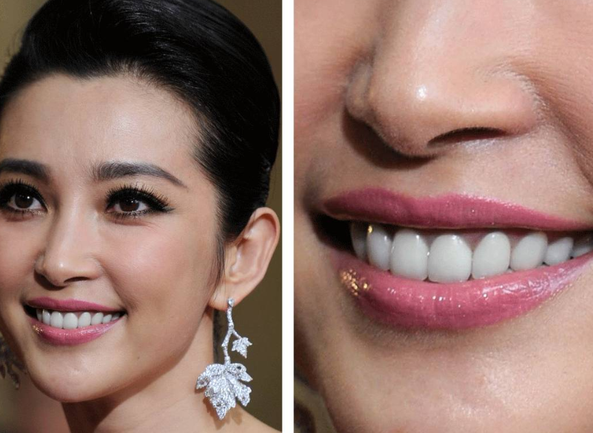 明星"烤瓷牙"有多不真实?镜头下反光,像一口假牙