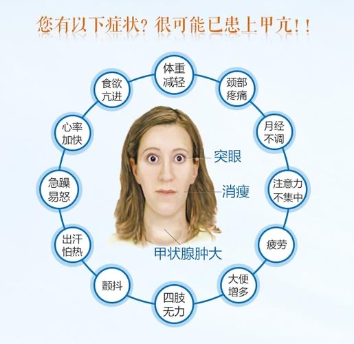 甲亢突眼的7項自測,你還在治療的