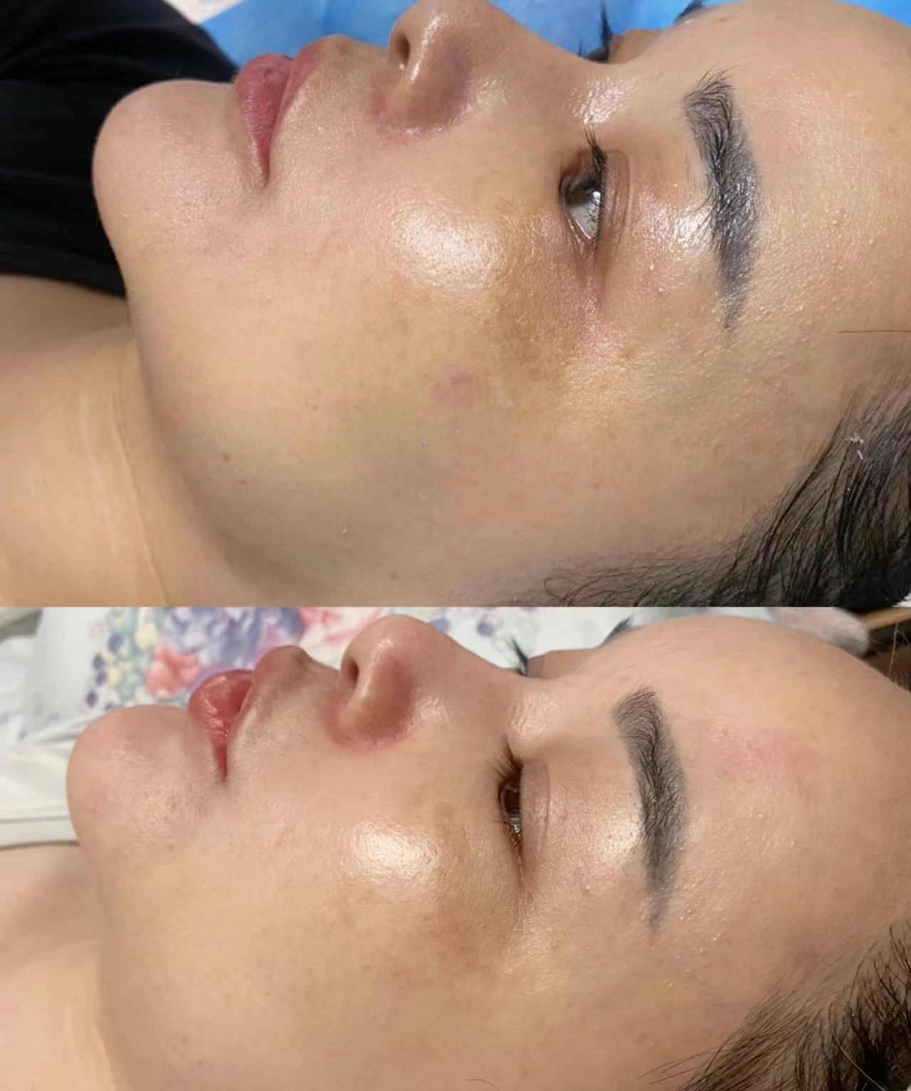 "瘦脸针"多受女明星青睐?王菲,柳岩等明星曾坦言自己注射过