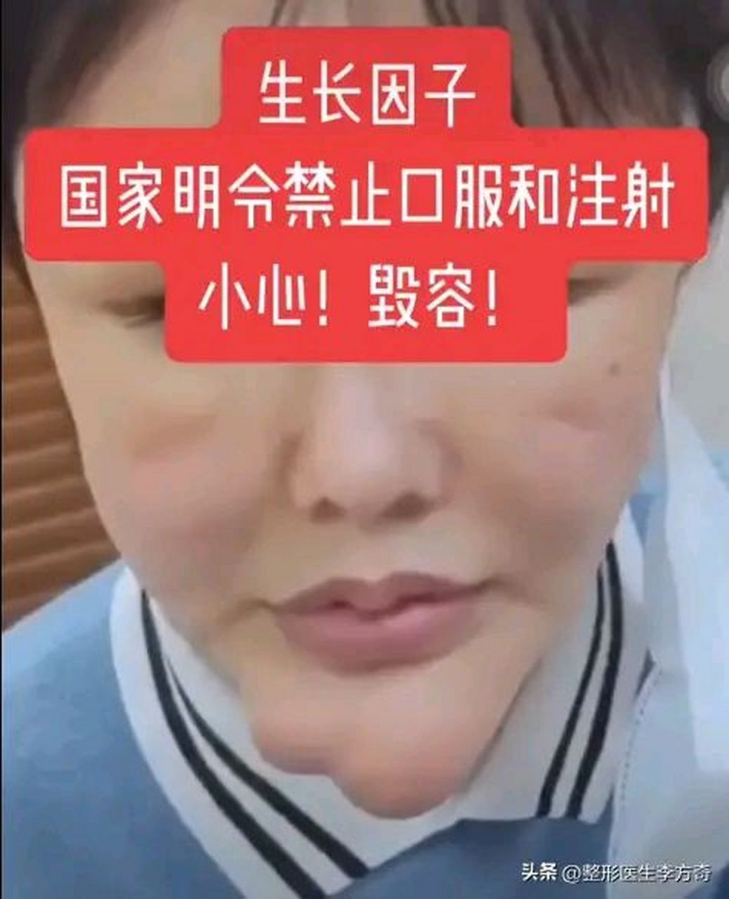 打了生长因子的后遗症有多可怕!#医美整形