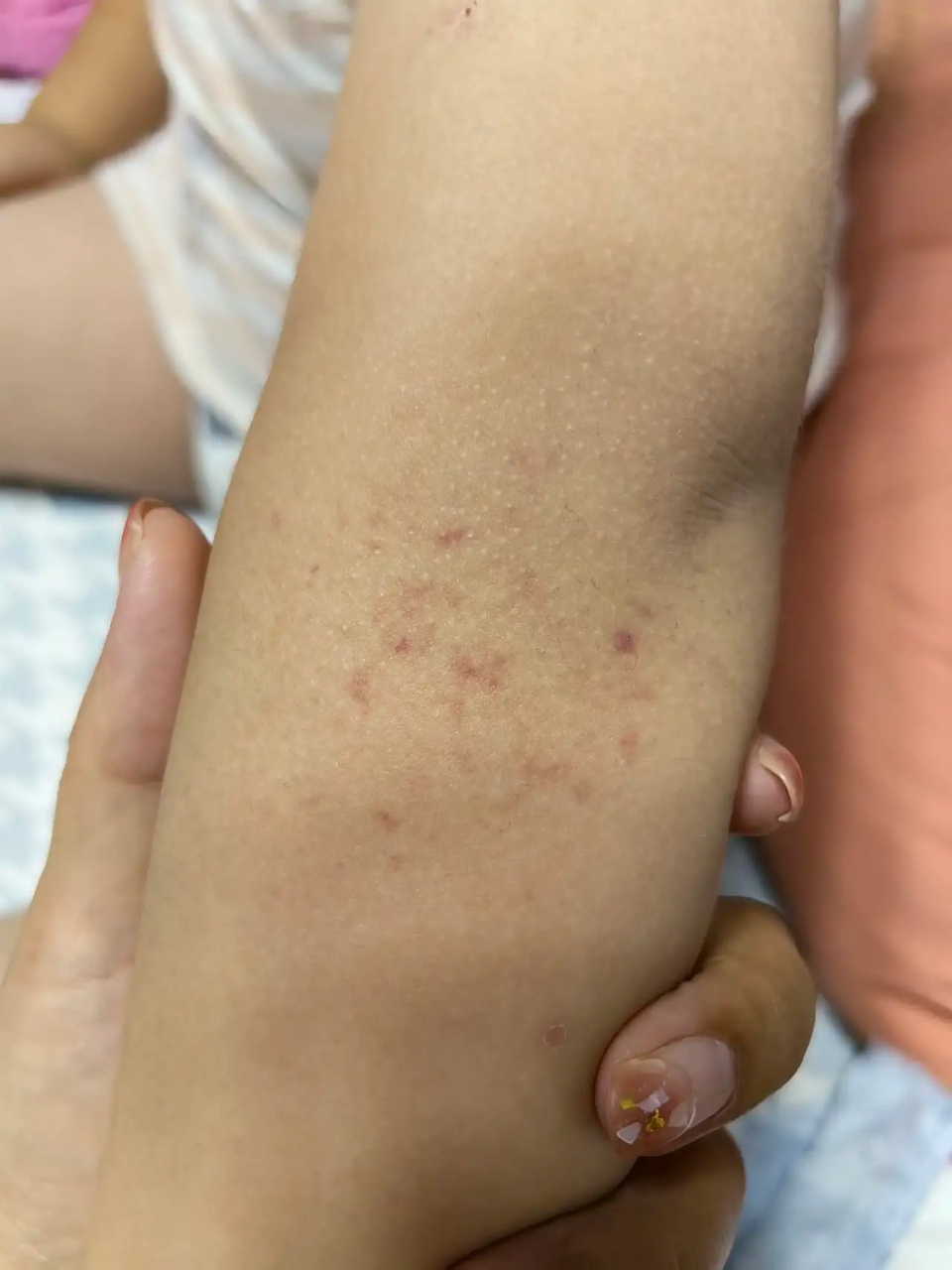 亲们知道这是什么吗 是出血点吗 是在皮肤里面 没有凸出来 而且很奇怪