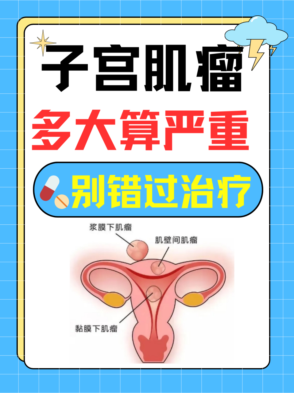 子宫肌瘤多大算严重 别错过治疗#子宫肌瘤# #女性# #妇科