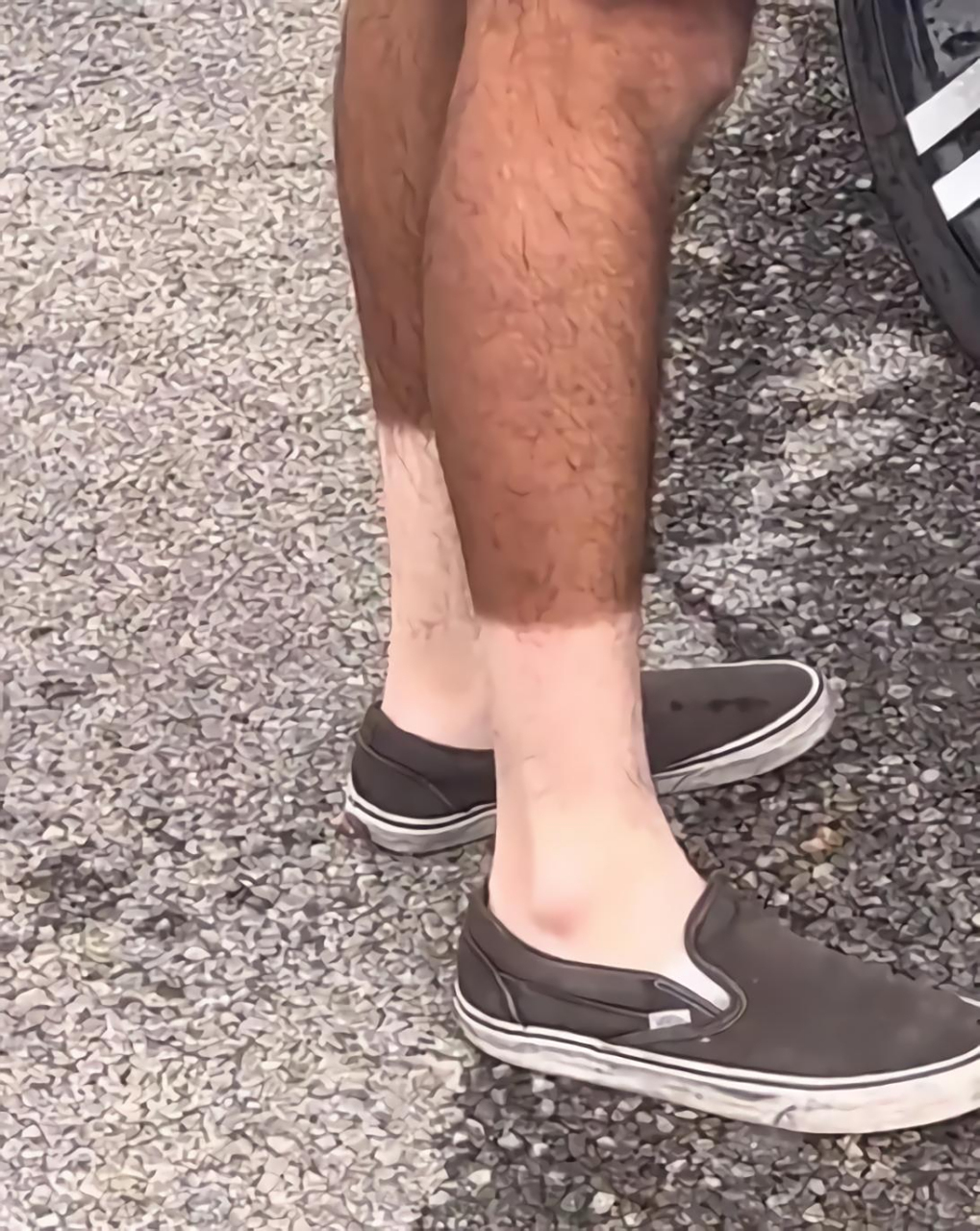 真是黑白分明,两极分化太明显了