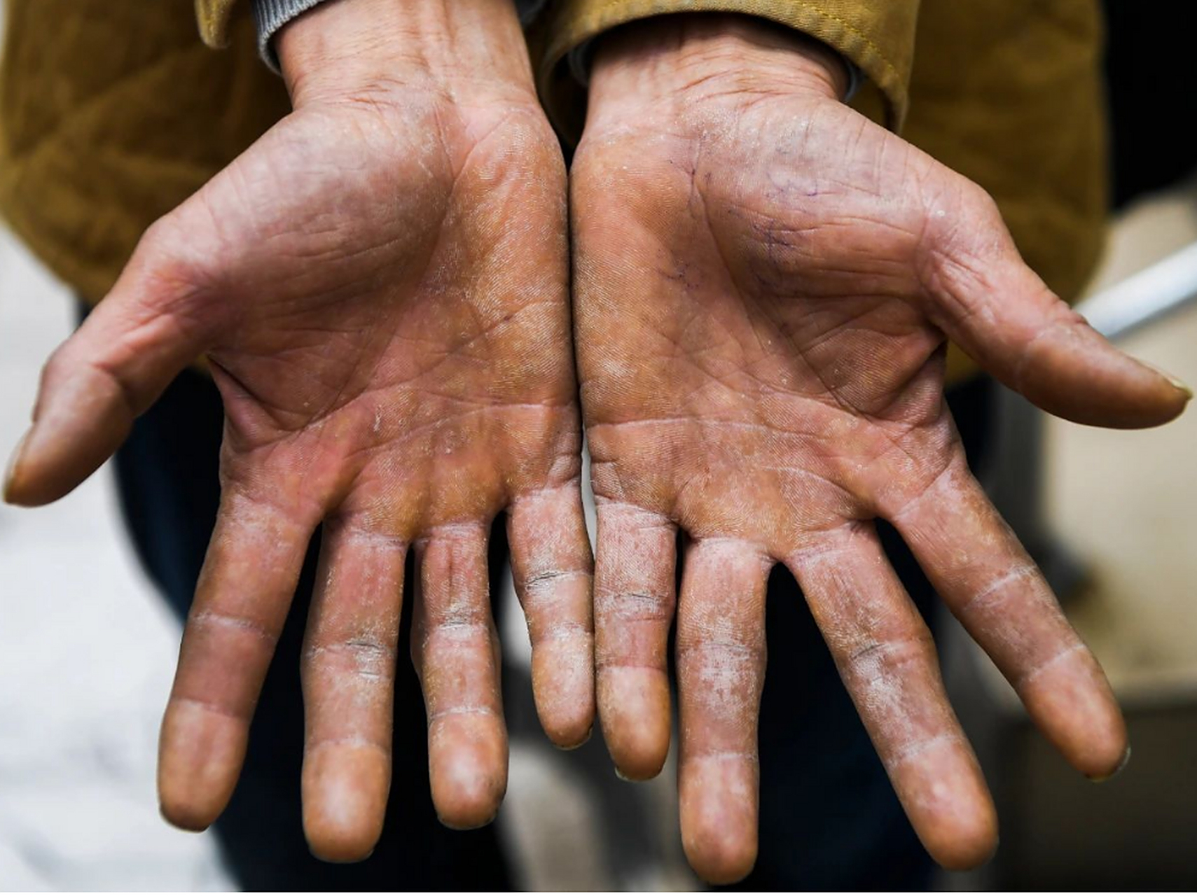 这是一双饱尽沧桑的劳动人民的双手