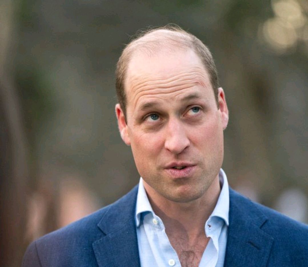 脱发专家预测:未来两三年,哈里王子将像威廉一样秃顶