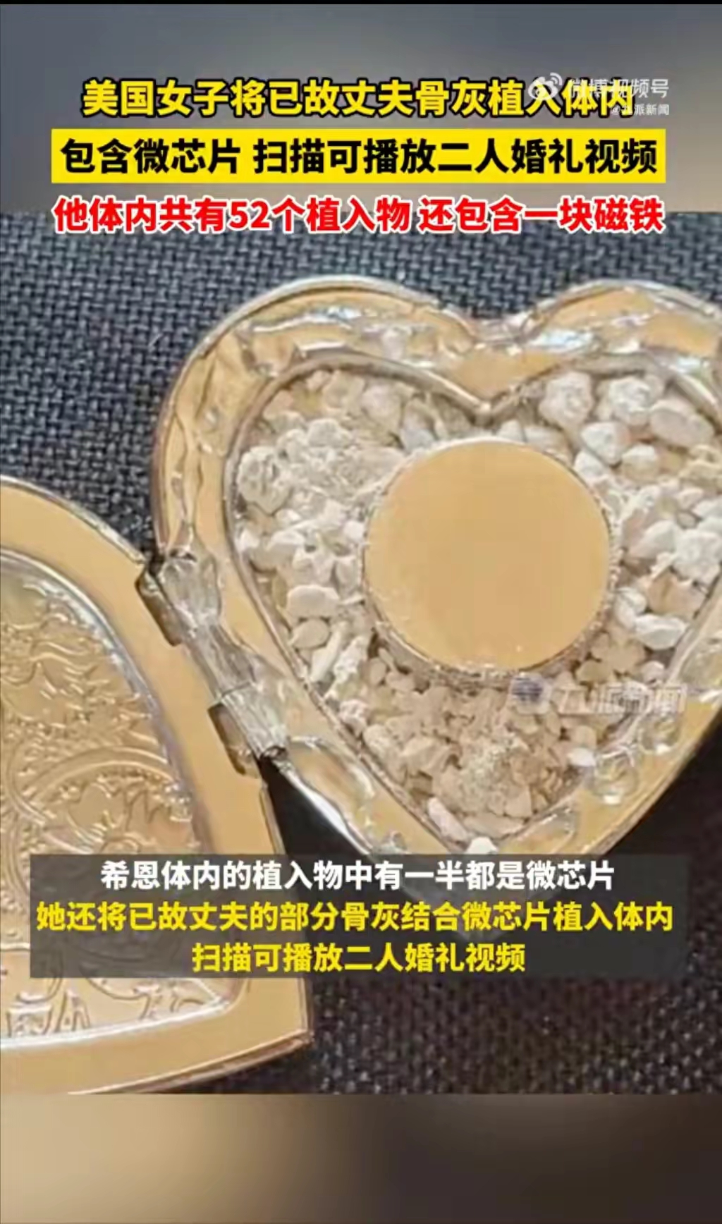 震惊全球!女子体内植入52个微芯片,打破世界纪录,更藏感人故事