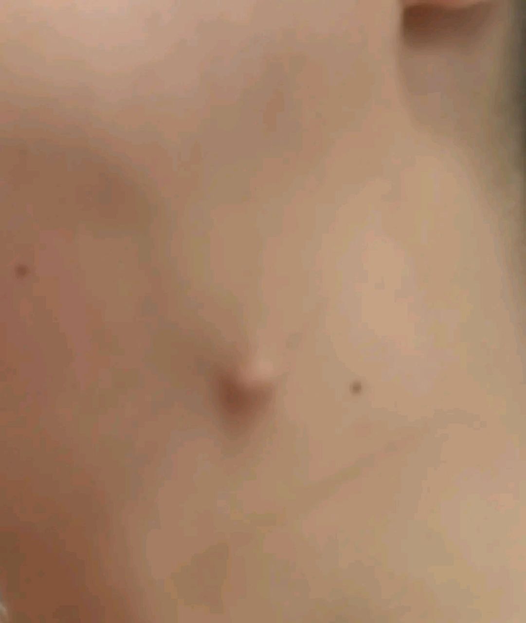 "我指着颈部的小疙瘩说:"这里不知道