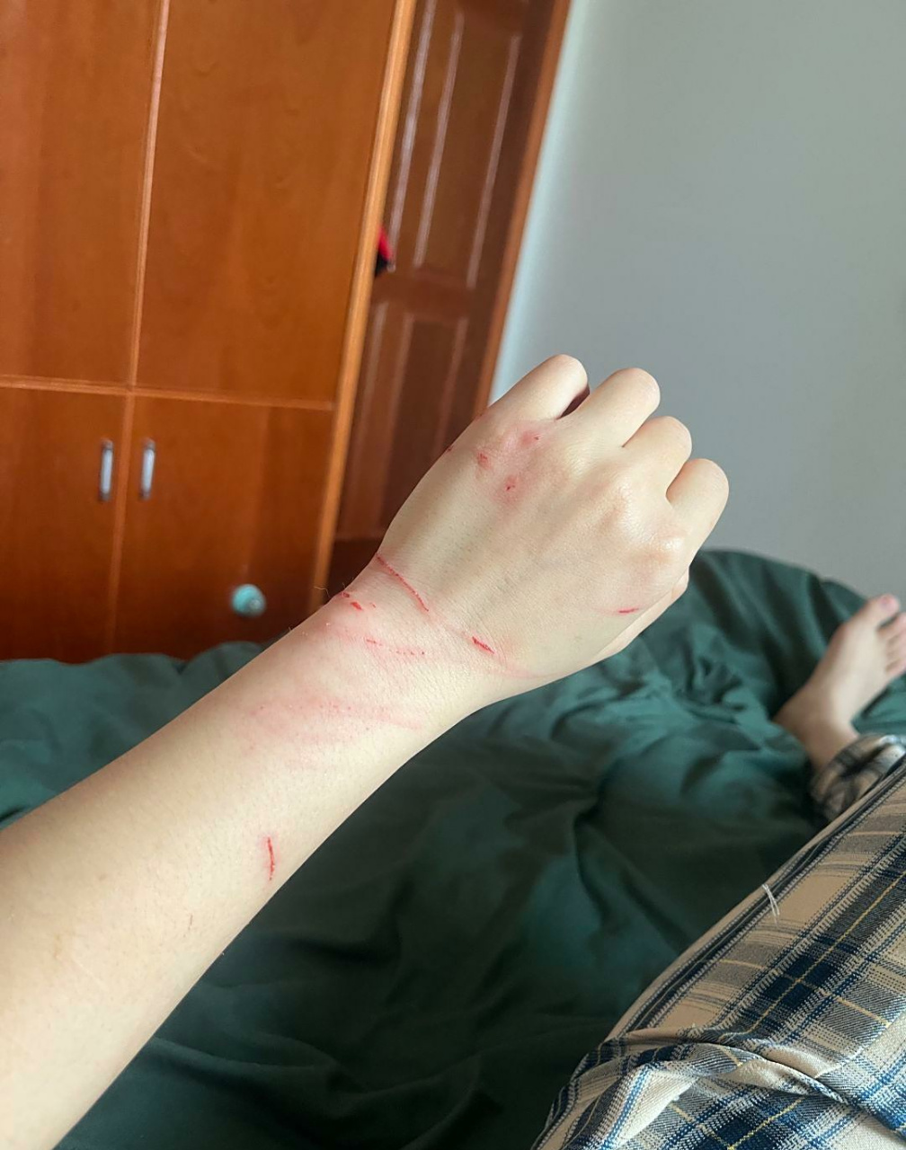 被猫抓的需要打疫苗吗