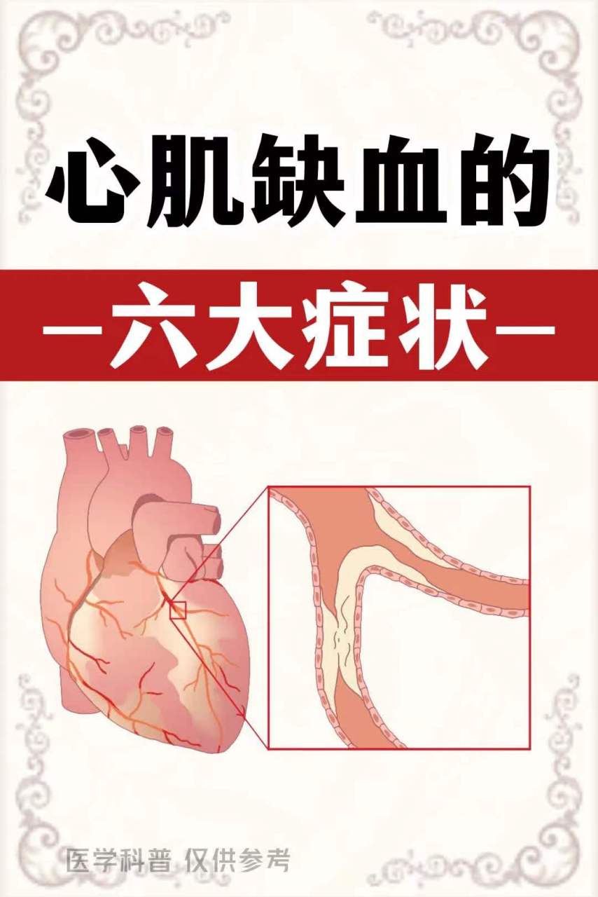 心肌缺血的6大症状#心脏