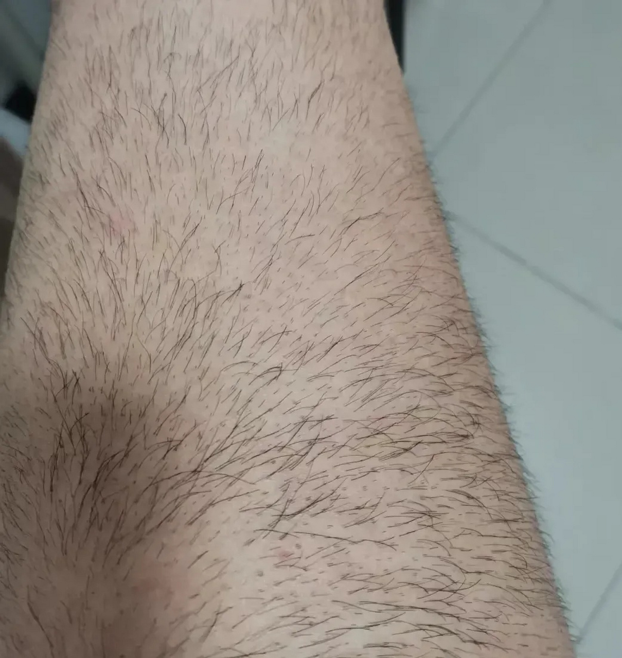 媒婆介绍的相亲对象,看到她这腿上的毛毛,不忍直视!