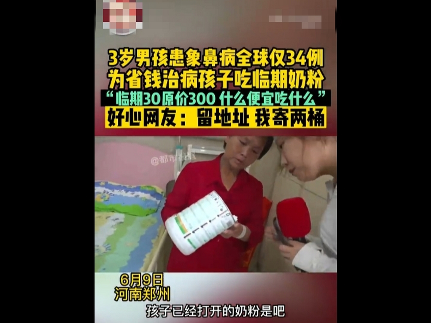 3岁男孩患象鼻病全球仅34例 6月9号河南郑州3岁一男孩患象鼻病住院