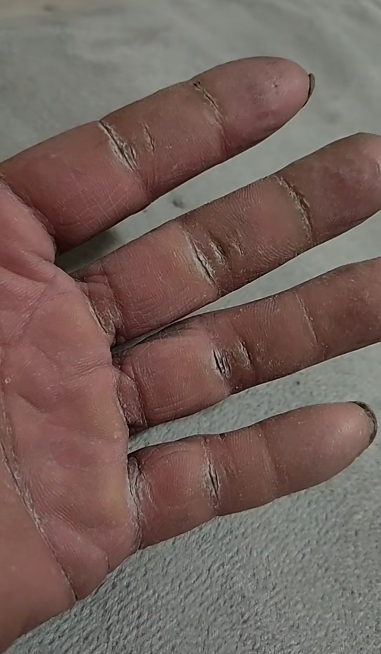 这就是劳动人民的手啊,看到老哥的手感到莫名的心酸!