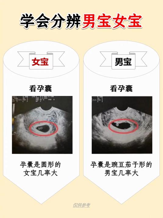孕囊是圆形的女宝几率大 孕囊是豌豆茄子形的男宝几率大