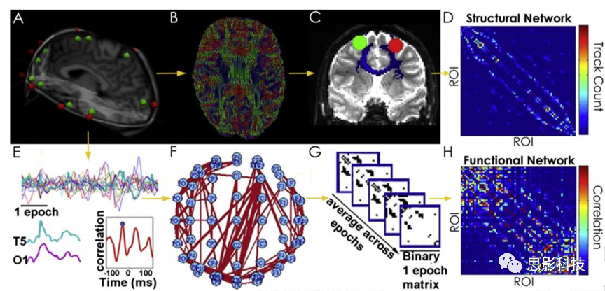 大脑白质连通性可以部分预测脑电(eeg)的功能连接