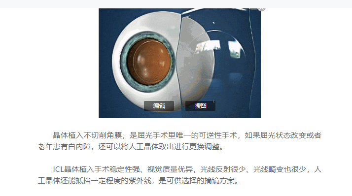 成都爱尔周进解析1000,1800度近视患者可选?摘镜方案!