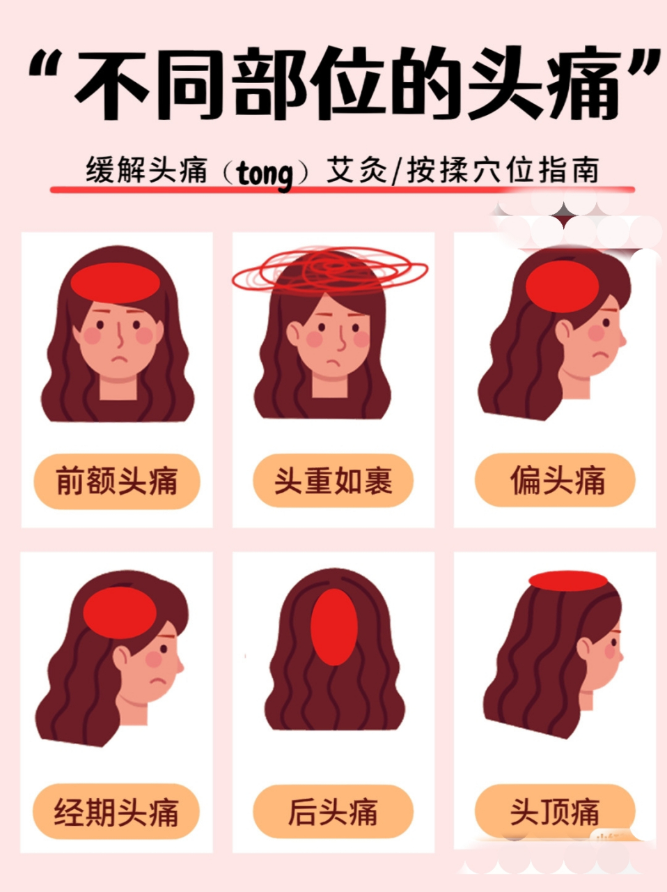 6种头痛快速缓解[加油][加油][加油]不同部位的头痛#中医养生