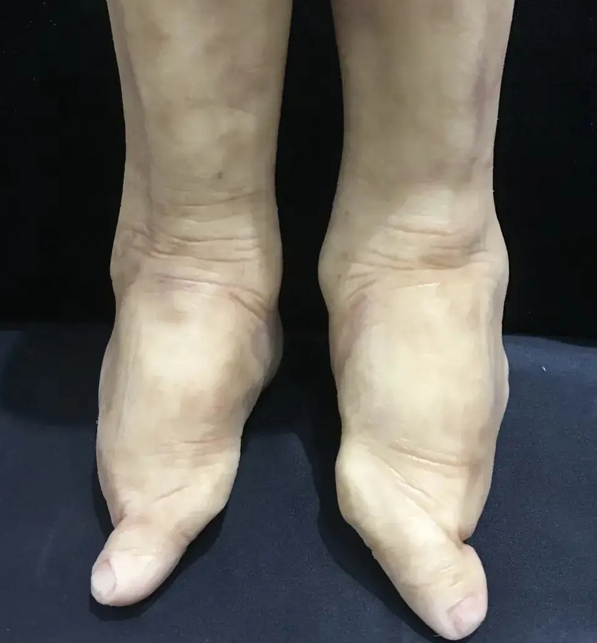 古代的三寸金莲,封建社会的畸形美很奇葩,不仅让人看着很恐怖,还感觉