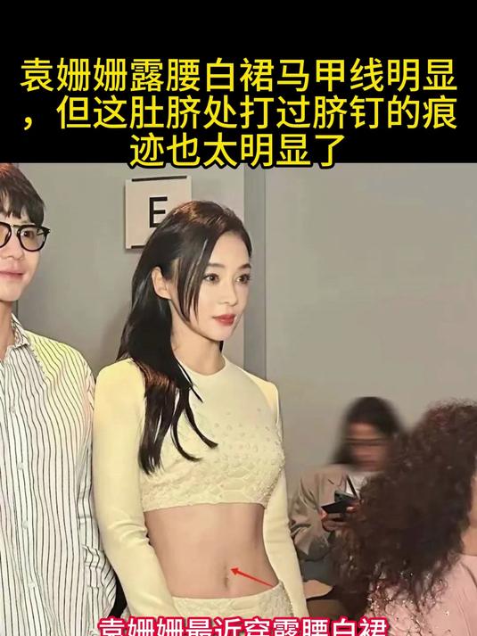 袁姗姗露腰白裙马甲线明显,但这肚脐处打过脐钉的痕迹也太明显了