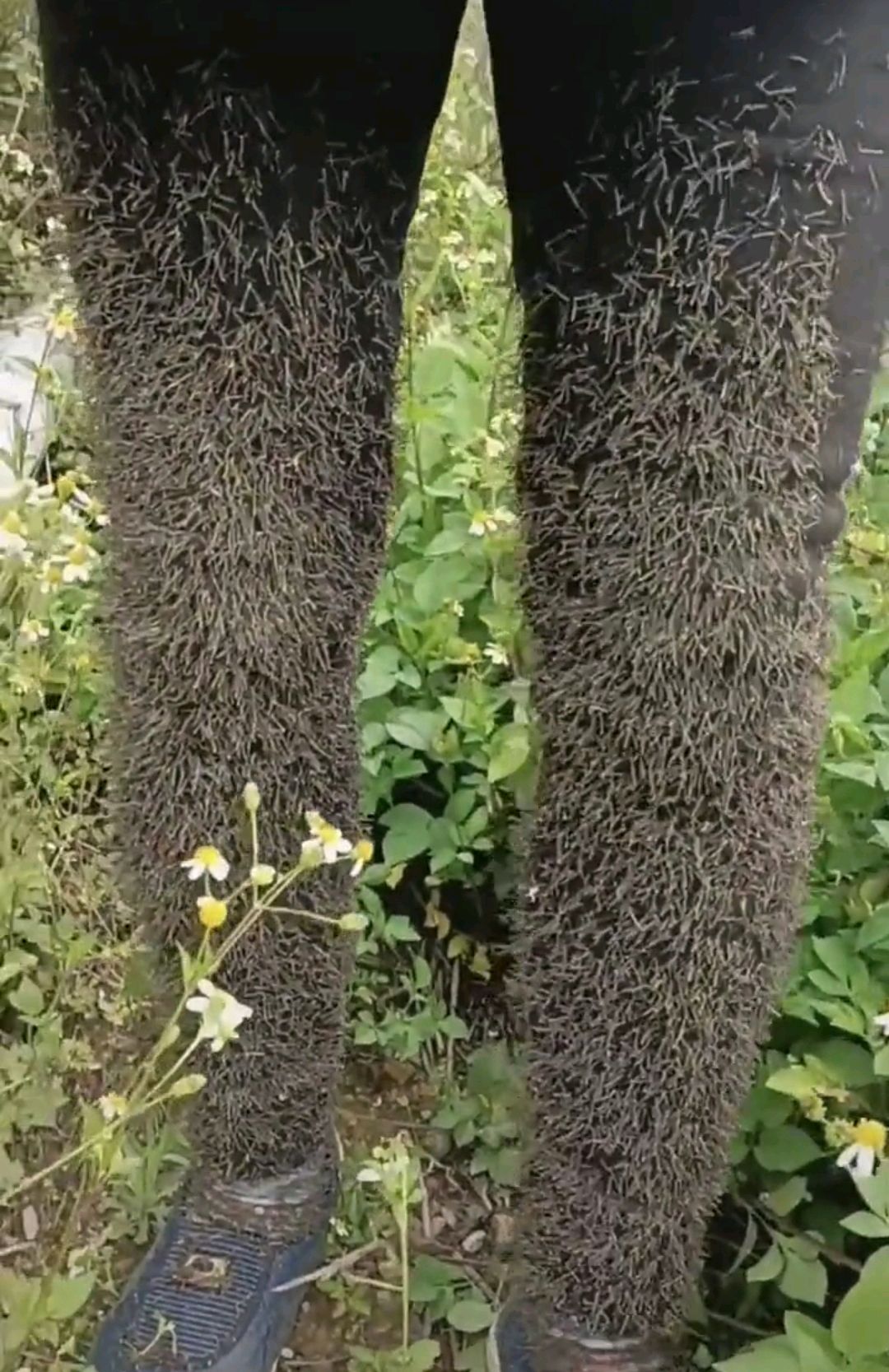 大妈两条腿好像大猩猩的一样,扎满了狗爪爪