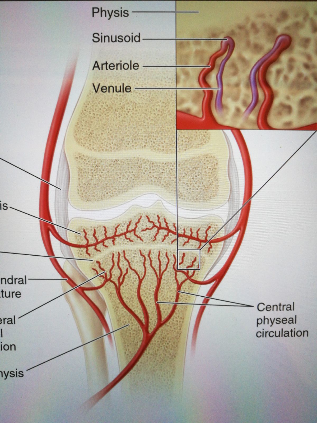 下肢骨髓炎患者的锻炼方法有哪些