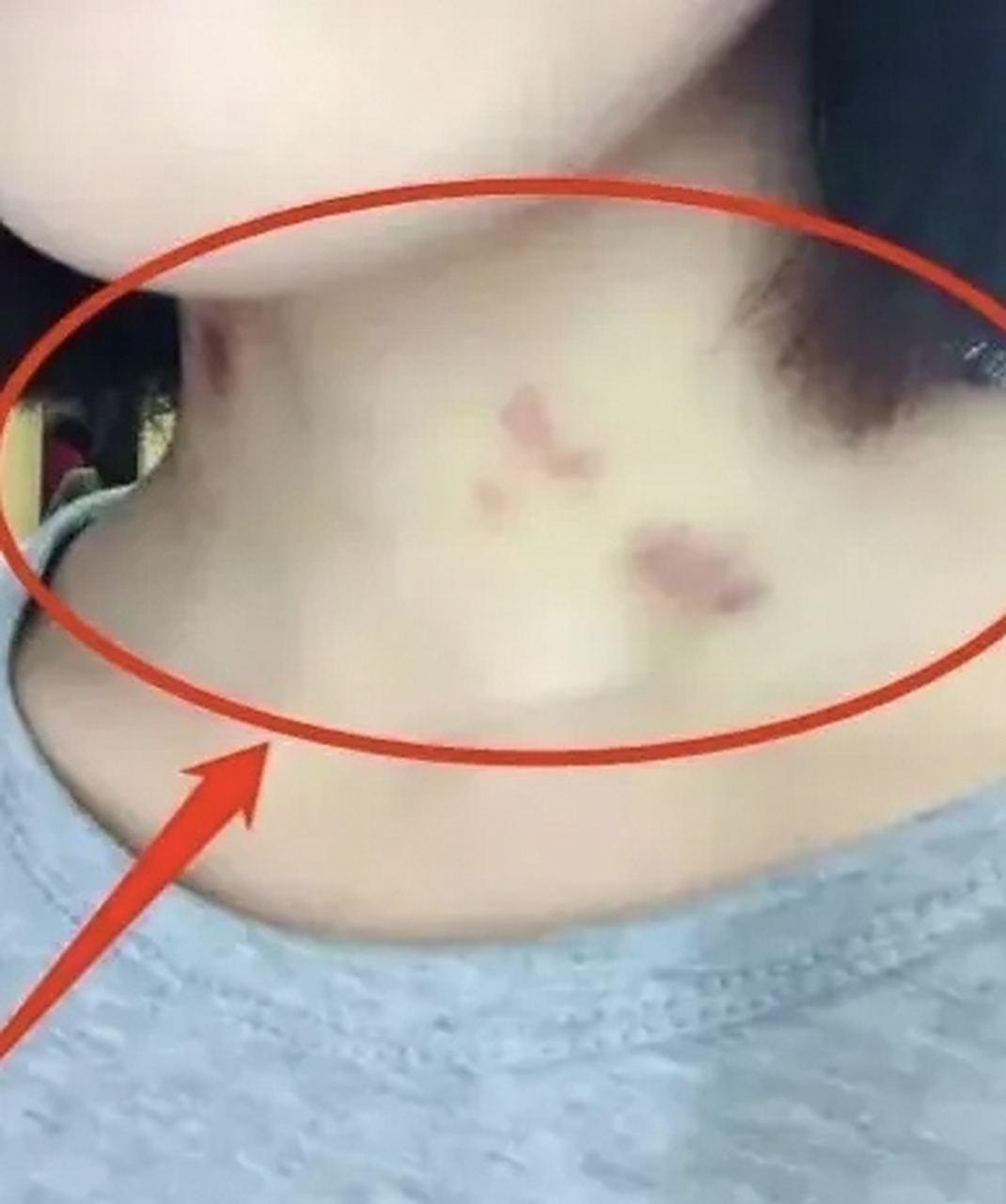 最近发现一个奇怪的现象,我的一位同事他脖子经常出现草莓印,我根本不