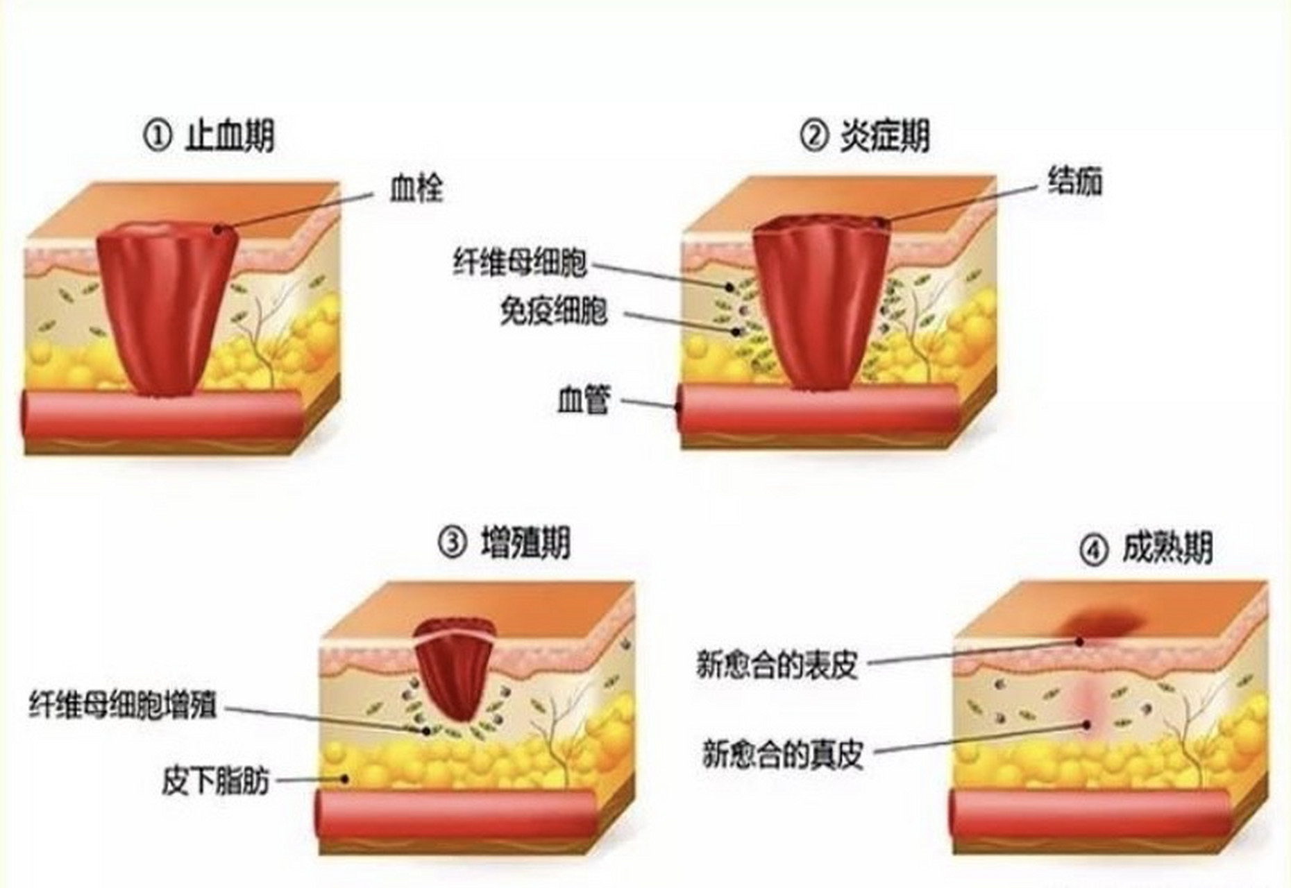 伤口愈合过程 磕磕碰碰的伤口,伤口不处理一下吗?