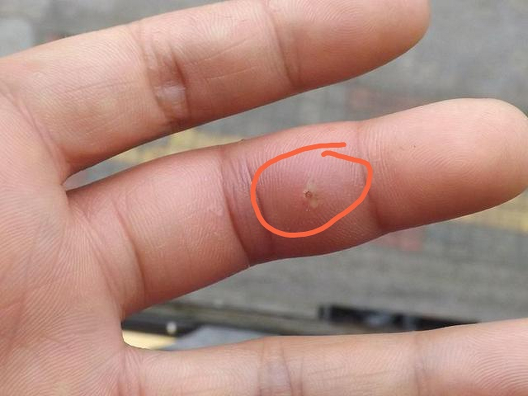 手上扎木刺了不要用针挑,教你一招,刺自动跑出来,太实用了  在日常