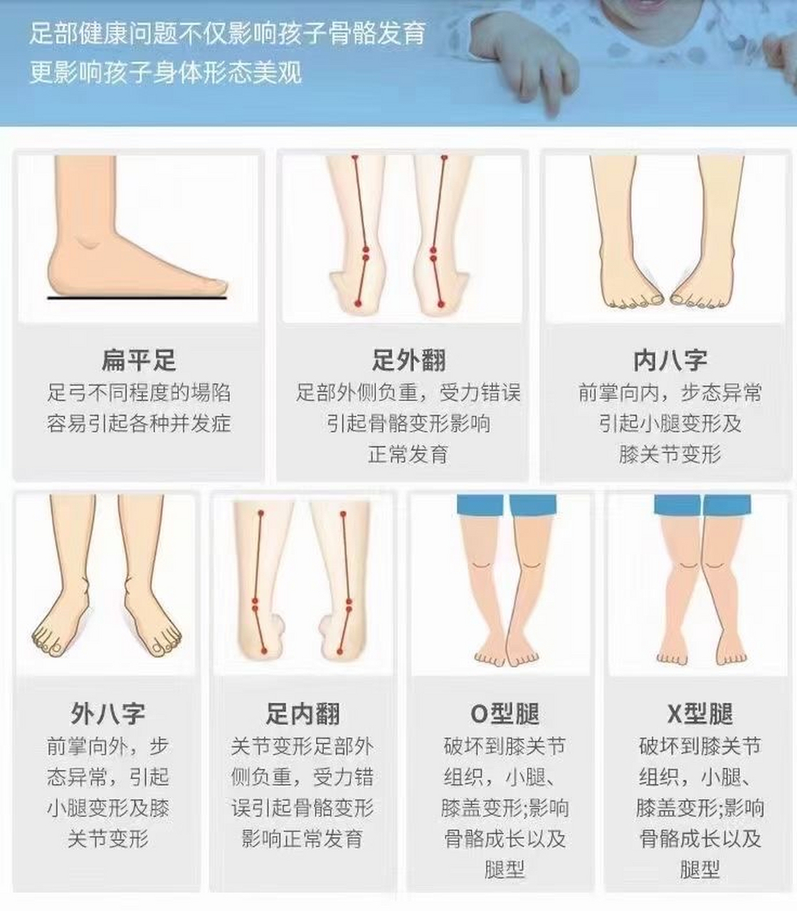 足作为人站立,行走等活动中最为关键的部位,在帮助维持正常的运动能力