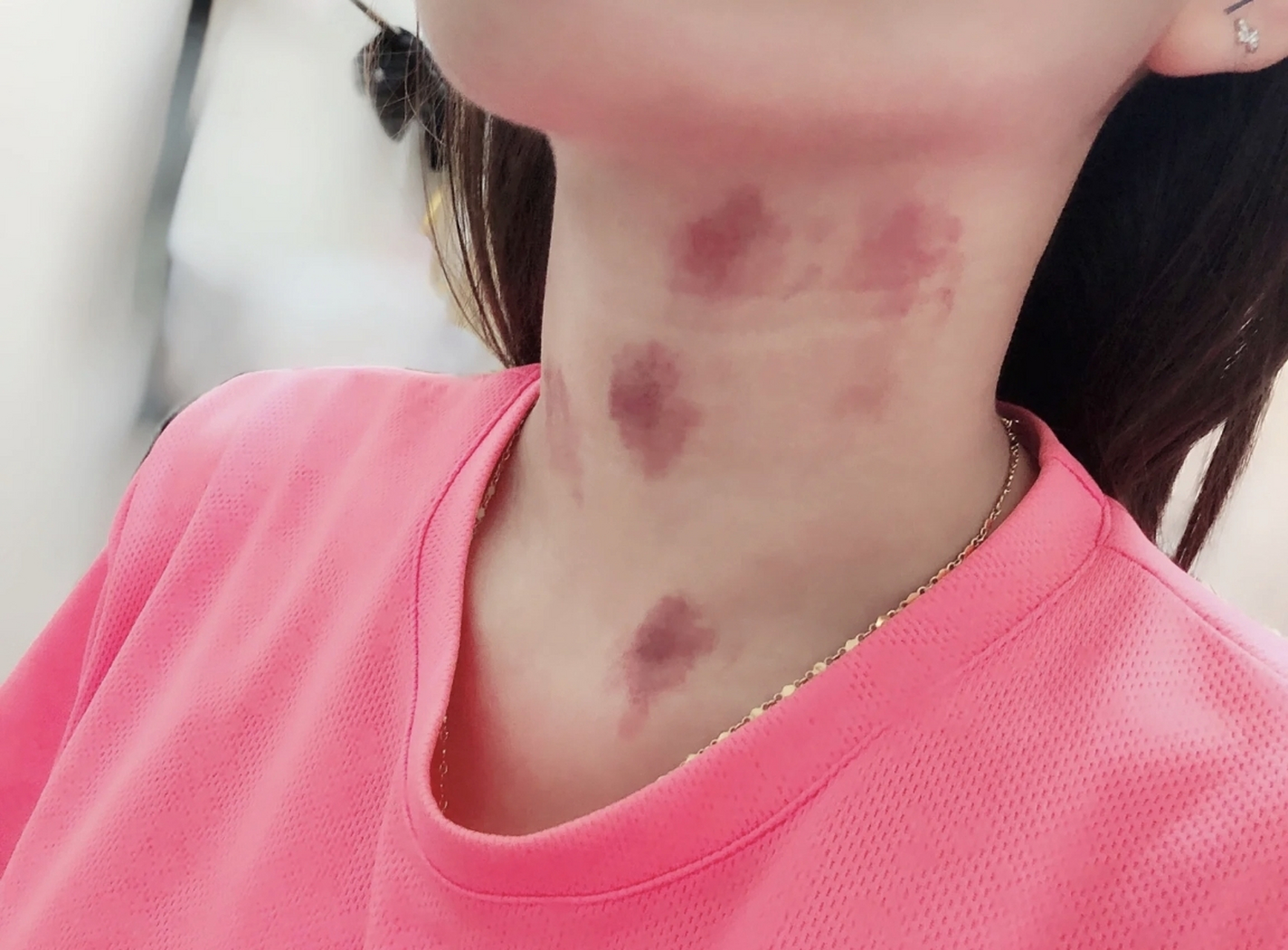 网友:你们的另一半会不会也喜欢种草莓,气死了,竟然可以把脖子吸成