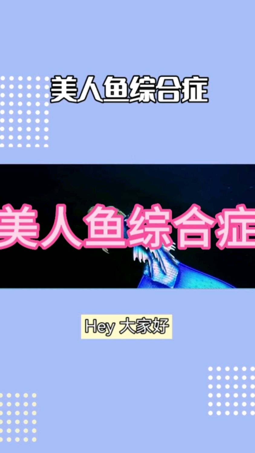 世界最美丽的病之一 美人鱼综合症