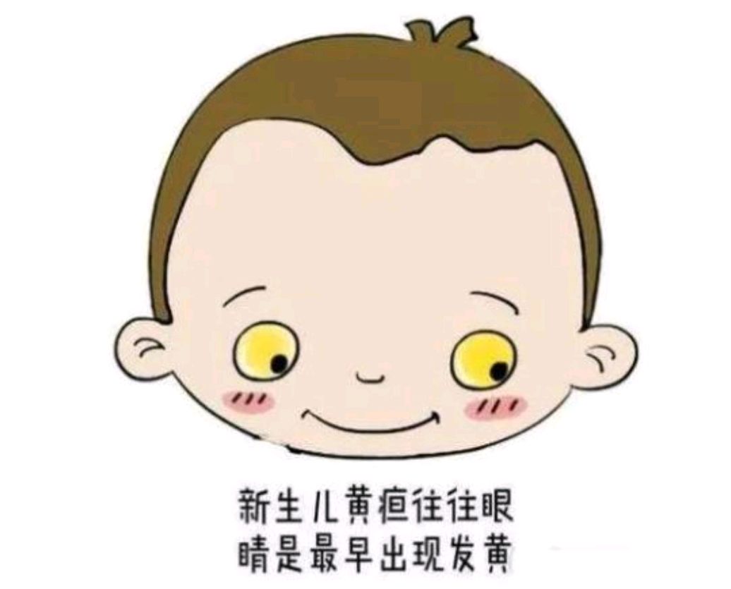 溶血性黄疸的护理