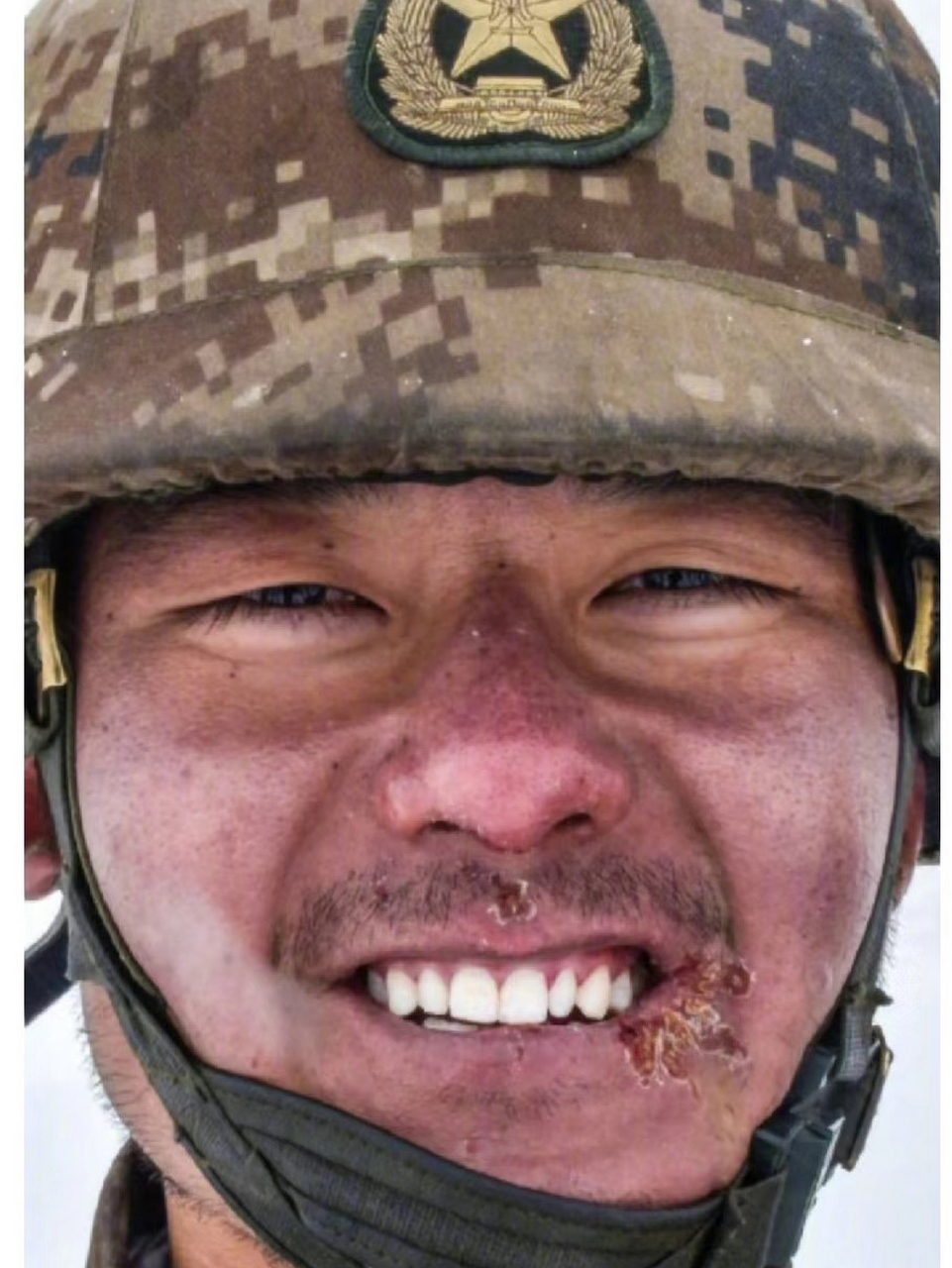 这是一张让人心疼的照片,在高原地区驻守的解放军士兵看到记者的镜头