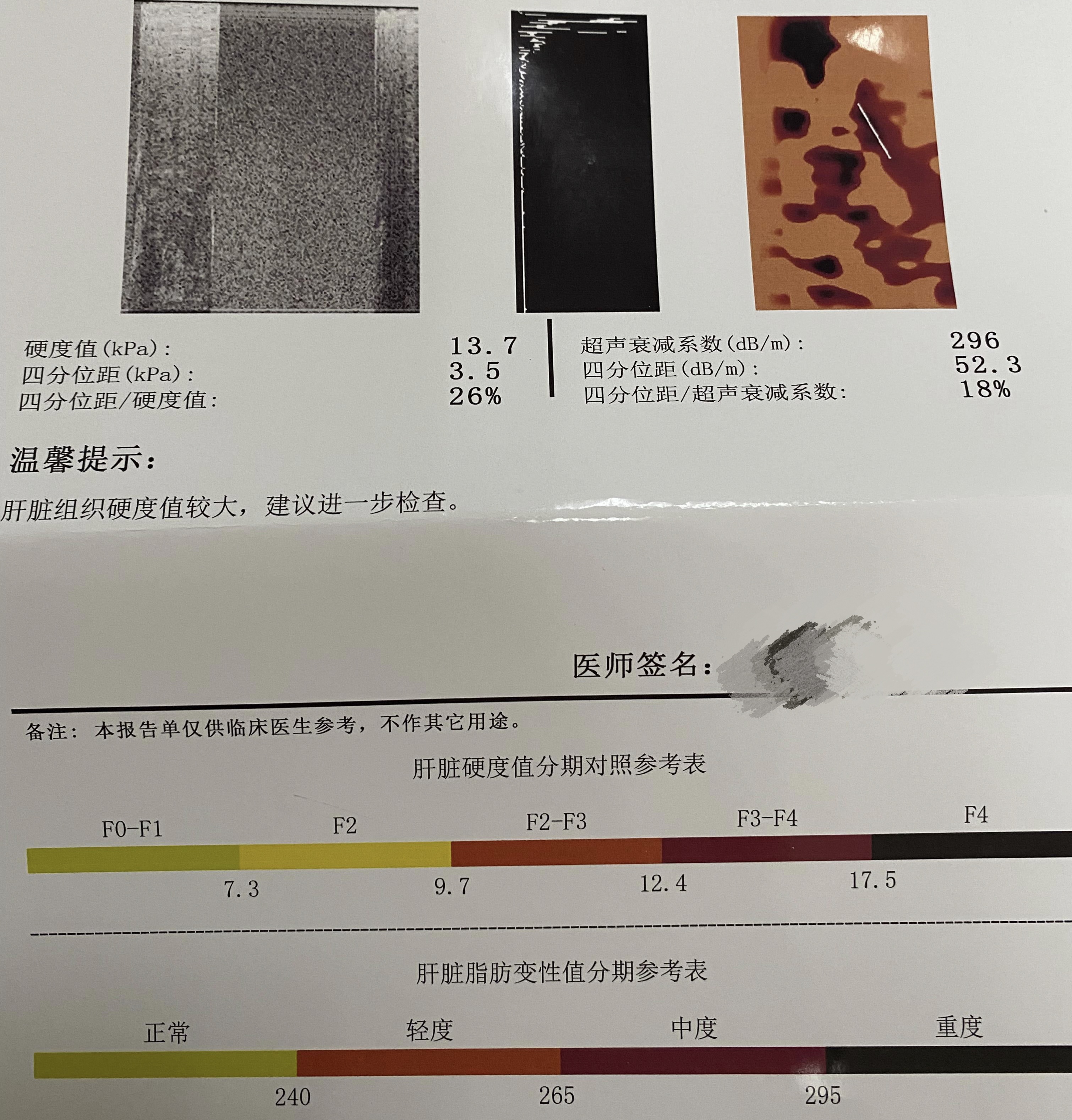 4,这是启动抗病毒以及纤维化进展的一个指标,当进展到相应的指标的