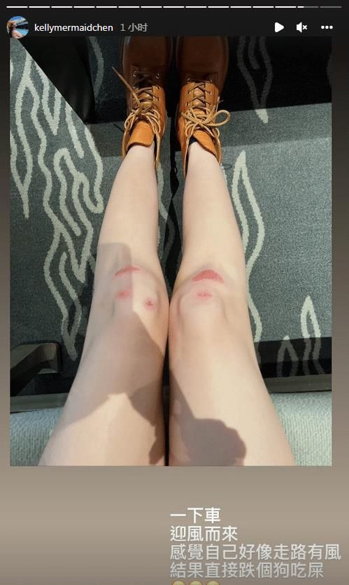 陈若仪晒腿受伤照,膝盖破皮的伤口触目惊心,林志颖看得心疼不已