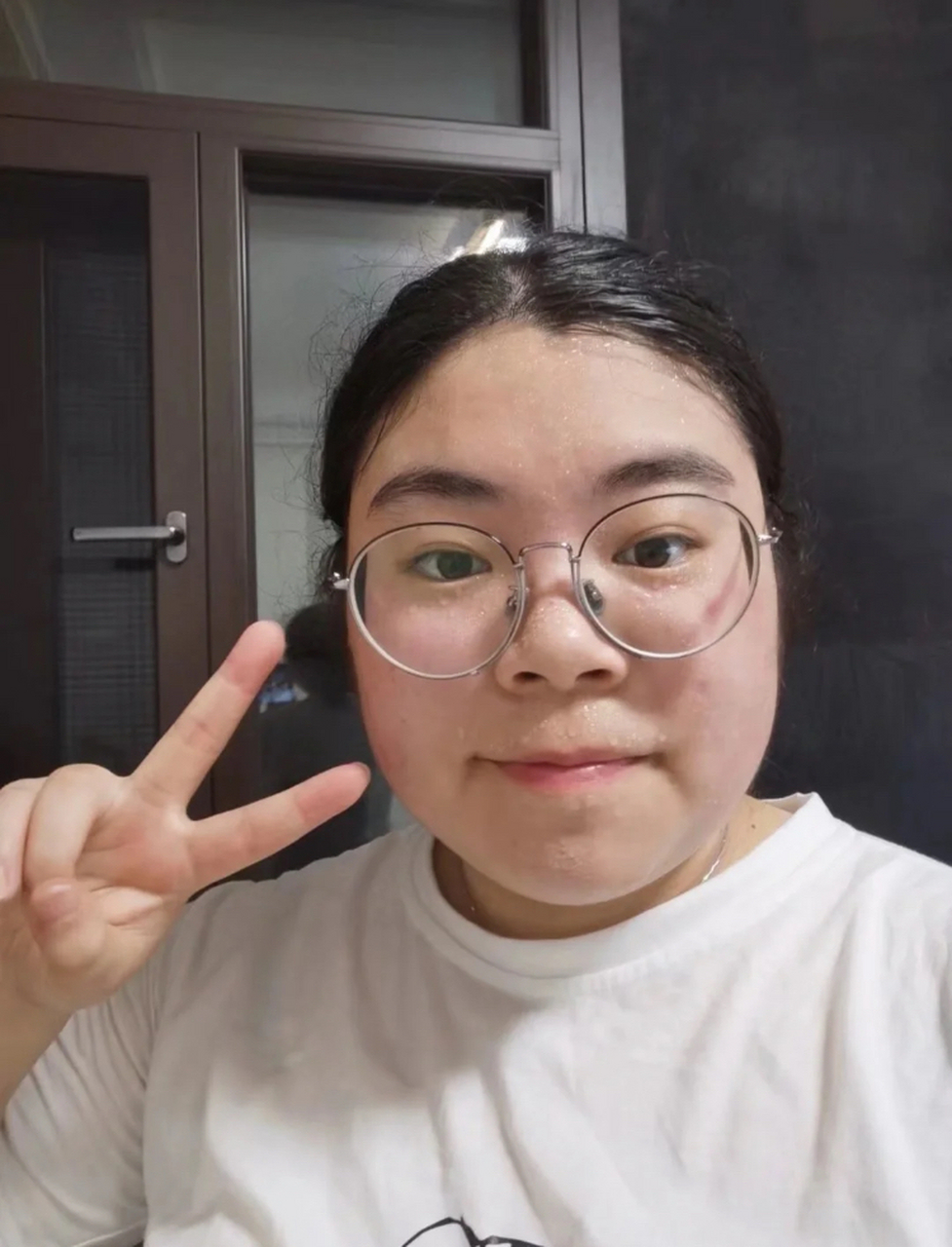 还好后来找对方法,好了,这些年也没没有复发,越来越美腻#甲减